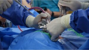 sequelas da cirurgia de coluna